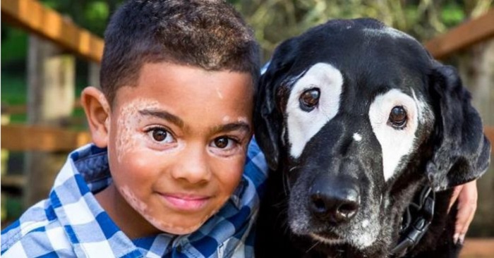 8-åringen har en hudåkomma och är deprimerad. Men se vad som händer efter mötet med denna hunden!
